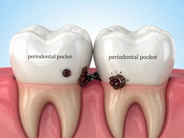 Jak odstranit zubní kámen pod dásní: metody a prevence