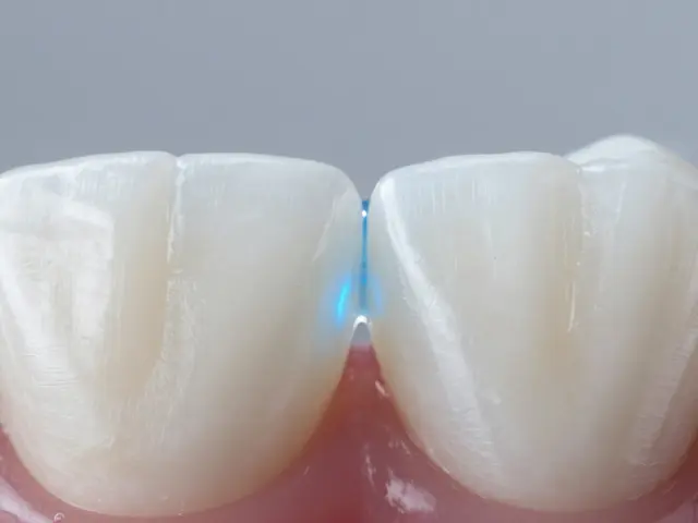 Jak zabránit vzniku mezizubního kazu: Ověřené tipy a správná hygiena